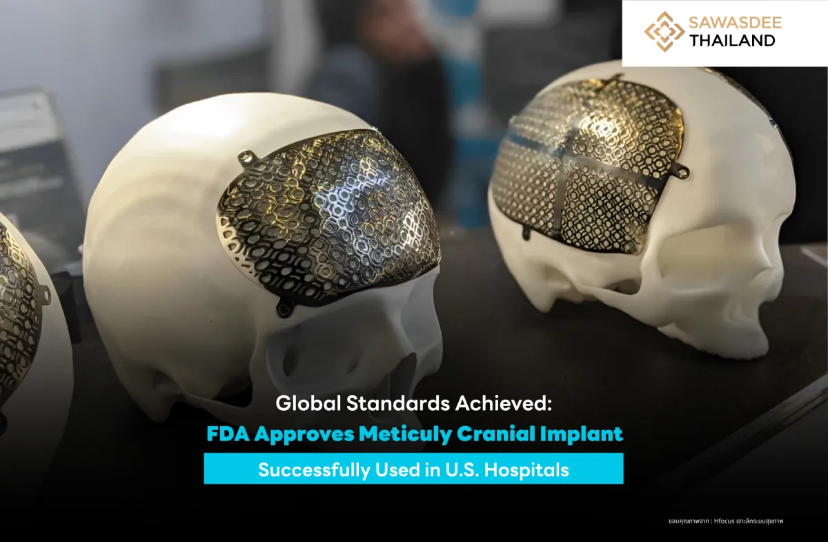 Global Standards Achieved: FDA Approves Meticuly Cranial Implant, Successfully Used in U.S. Hospitals