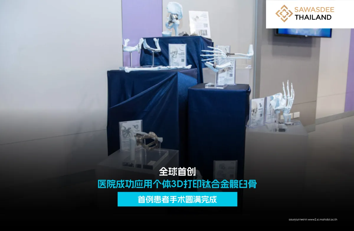 全球首创 医院成功应用个体3D打印钛合金髋臼骨 首例患者手术圆满完成